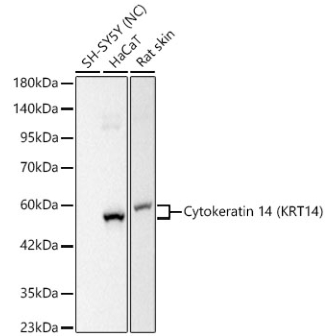 Cytokeratin 14 (KRT14) Rabbit Monoclonal Antibody