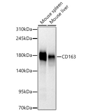 CD163 Rabbit Monoclonal Antibody