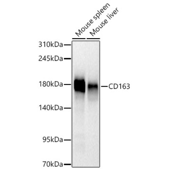 CD163 Rabbit Monoclonal Antibody