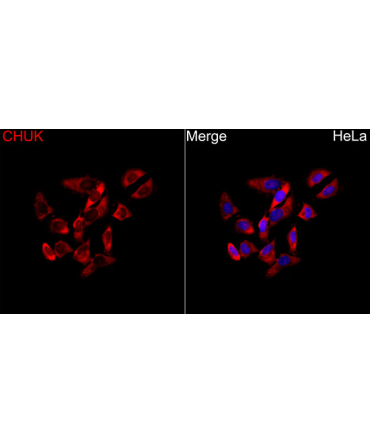 CHUK Rabbit Polyclonal Antibody