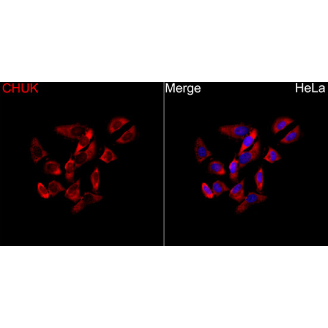 CHUK Rabbit Polyclonal Antibody