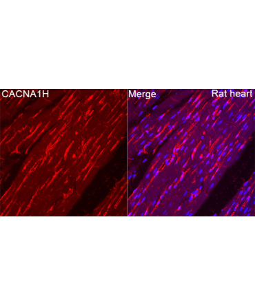 CACNA1H Rabbit Polyclonal Antibody
