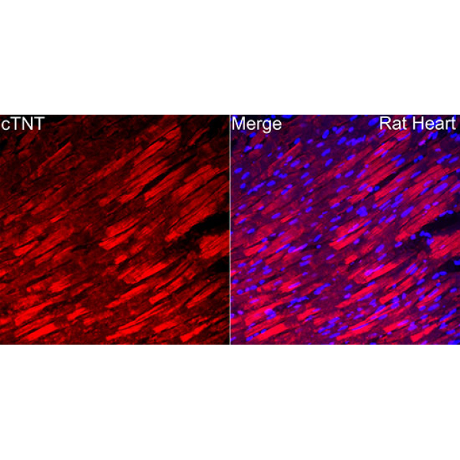 cTNT Rabbit Polyclonal Antibody