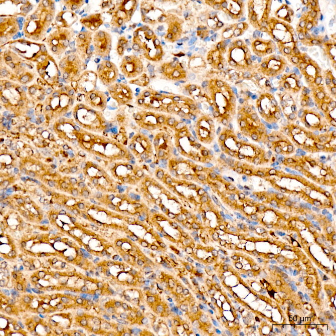 ACAC1 Rabbit Polyclonal Antibody