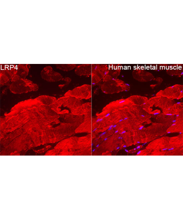 LRP4 Rabbit Polyclonal Antibody