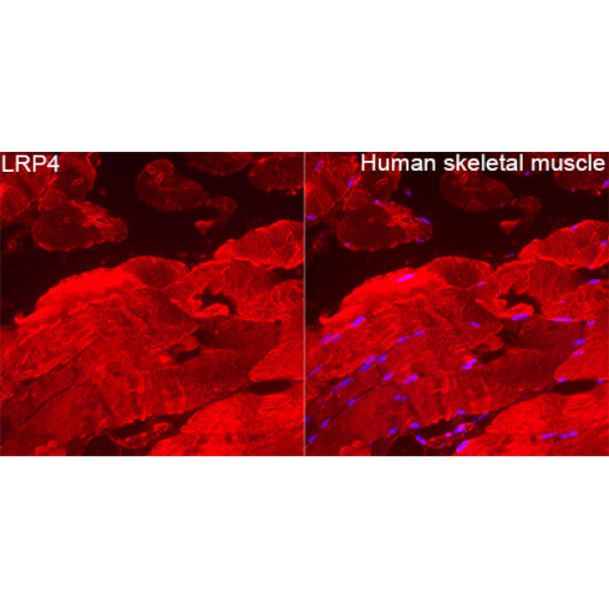 LRP4 Rabbit Polyclonal Antibody