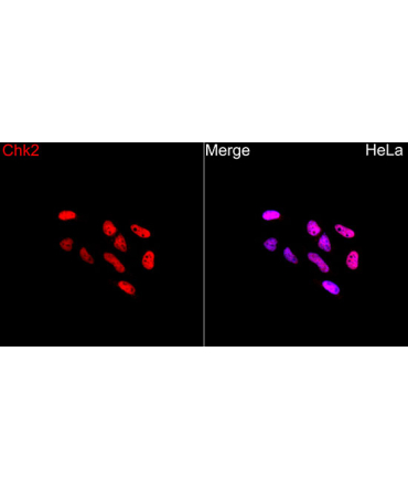 Chk2 Rabbit Polyclonal Antibody