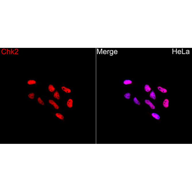 Chk2 Rabbit Polyclonal Antibody