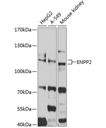 ENPP2 Rabbit Polyclonal Antibody