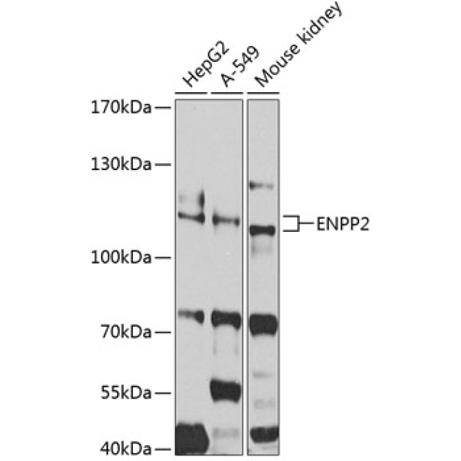 ENPP2 Rabbit Polyclonal Antibody