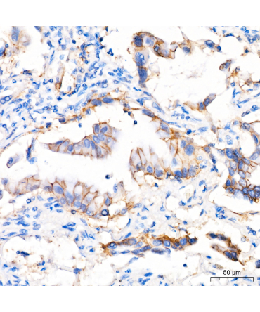 ABCA1 Rabbit Polyclonal Antibody