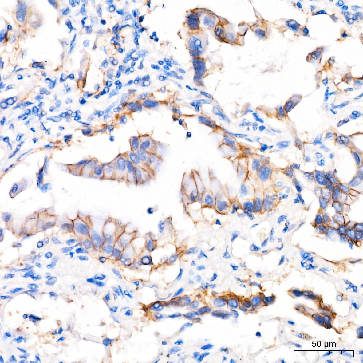 ABCA1 Rabbit Polyclonal Antibody