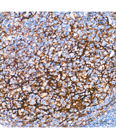 CD271 Rabbit Polyclonal Antibody