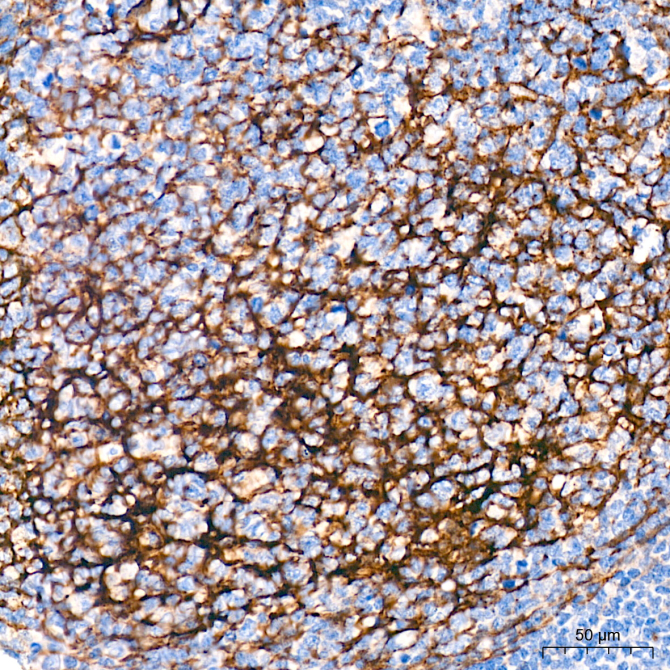 CD271 Rabbit Polyclonal Antibody