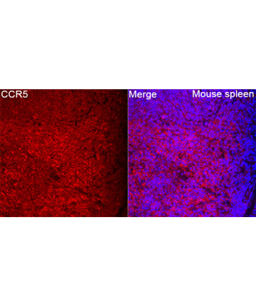 CCR5 Rabbit Polyclonal Antibody