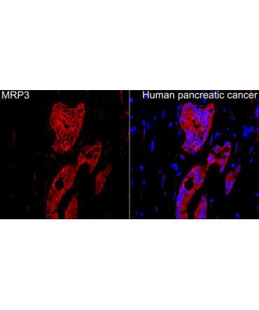 MRP3 Rabbit Polyclonal Antibody