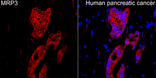MRP3 Rabbit Polyclonal Antibody