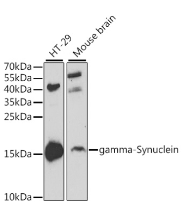 gamma-Synuclein Rabbit Polyclonal Antibody