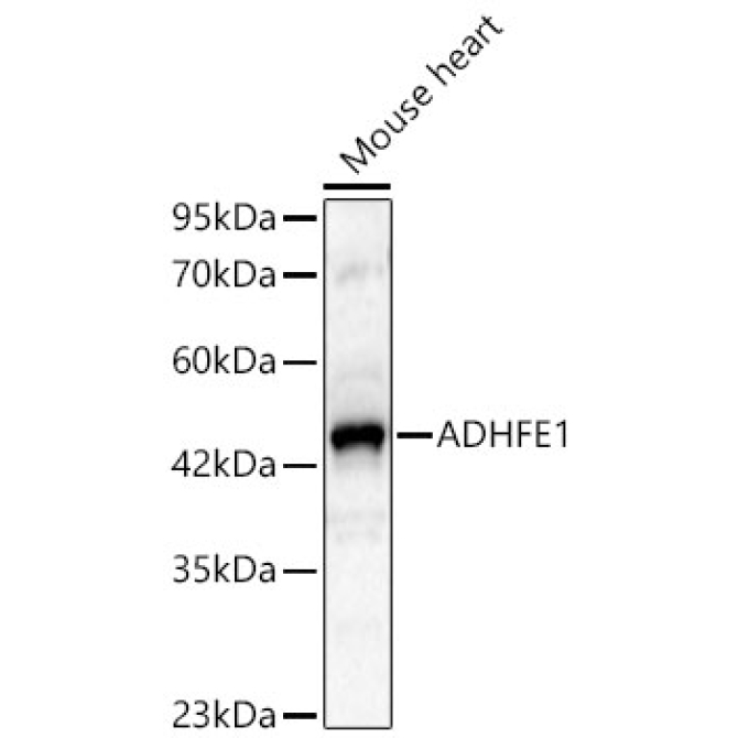 ADHFE1 Rabbit Polyclonal Antibody