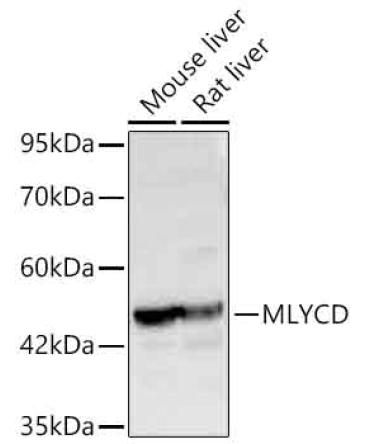 MLYCD Rabbit Polyclonal Antibody
