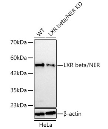 LXR beta/NER Rabbit Polyclonal Antibody [KD Validated]