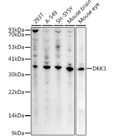 DKK3 Rabbit Polyclonal Antibody