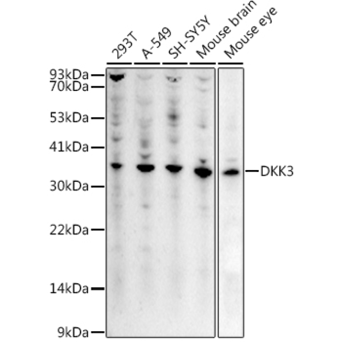 DKK3 Rabbit Polyclonal Antibody