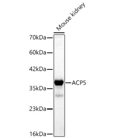 ACP5 Rabbit Polyclonal Antibody