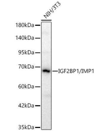 IGF2BP1/IMP1 Rabbit Polyclonal Antibody