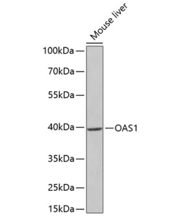 OAS1 Rabbit Polyclonal Antibody