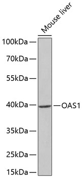 OAS1 Rabbit Polyclonal Antibody