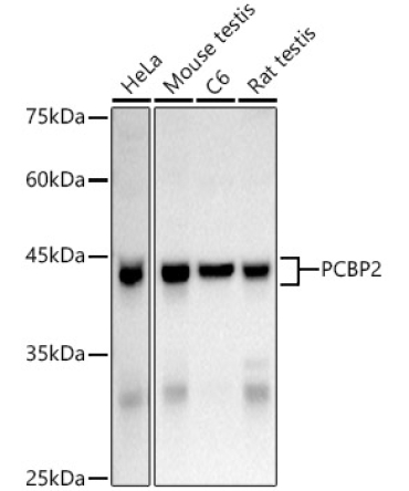hnRNP E2/PCBP2 Rabbit Polyclonal Antibody