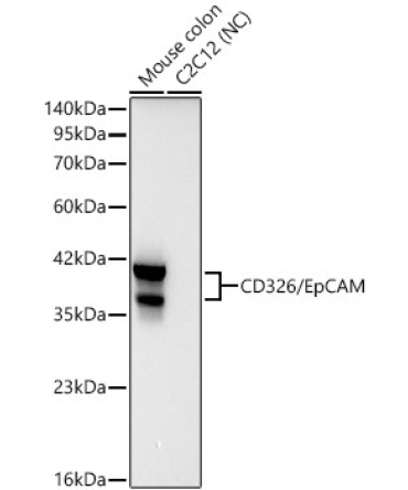 CD326/EpCAM Rabbit Monoclonal Antibody