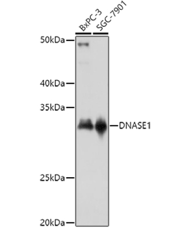 DNASE1 Rabbit Polyclonal Antibody