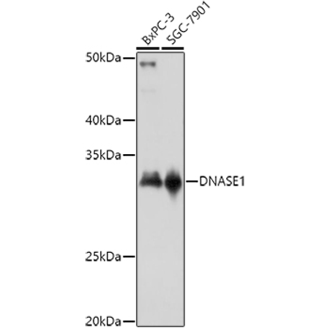 DNASE1 Rabbit Polyclonal Antibody