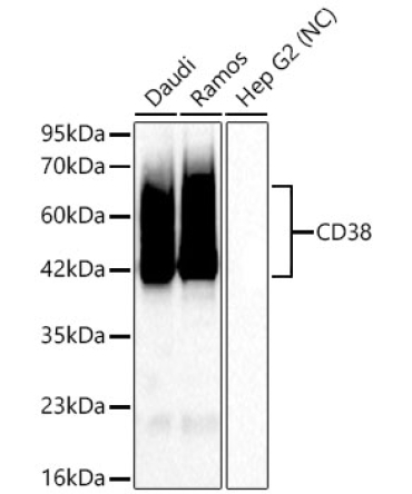CD38 Rabbit Monoclonal Antibody