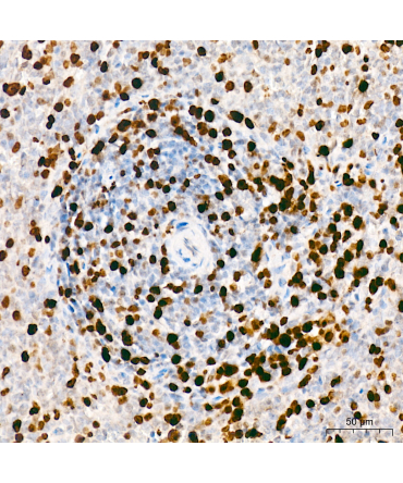 Mki67 Rabbit Polyclonal Antibody