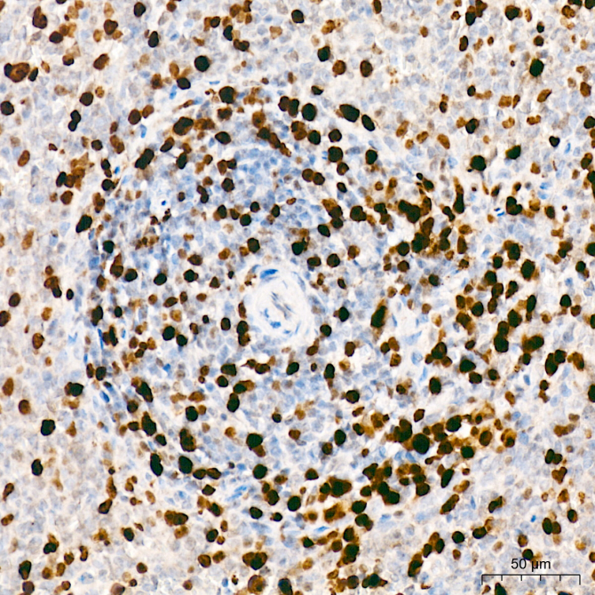 Mki67 Rabbit Polyclonal Antibody