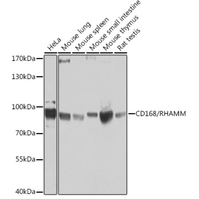 CD168/RHAMM Rabbit Polyclonal Antibody