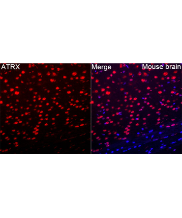 ATRX Rabbit Polyclonal Antibody