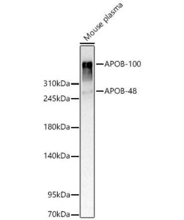 APOB Rabbit Polyclonal Antibody