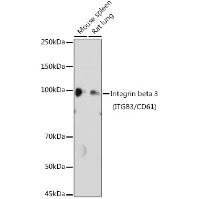 Integrin beta 3 (ITGB3/CD61) Rabbit Polyclonal Antibody