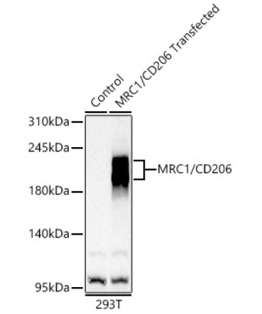 Mannose Receptor/CD206 Rabbit Polyclonal Antibody