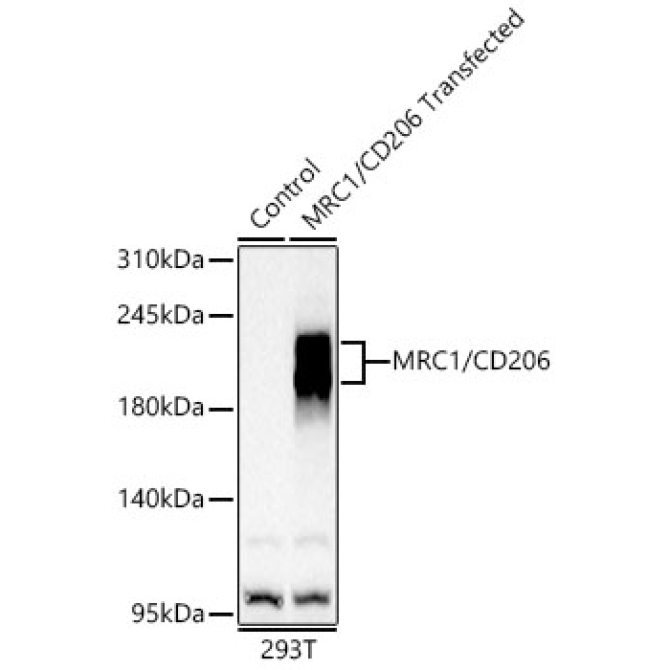 Mannose Receptor/CD206 Rabbit Polyclonal Antibody