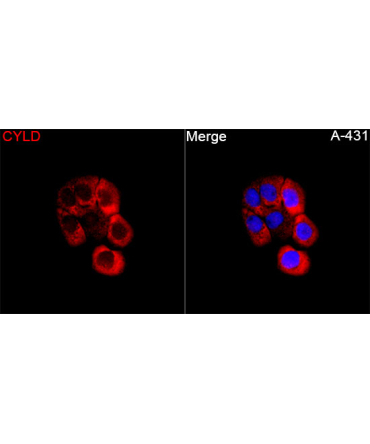 CYLD Rabbit Polyclonal Antibody