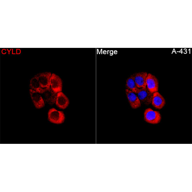 CYLD Rabbit Polyclonal Antibody