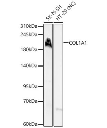 COL1A1 Rabbit Polyclonal Antibody