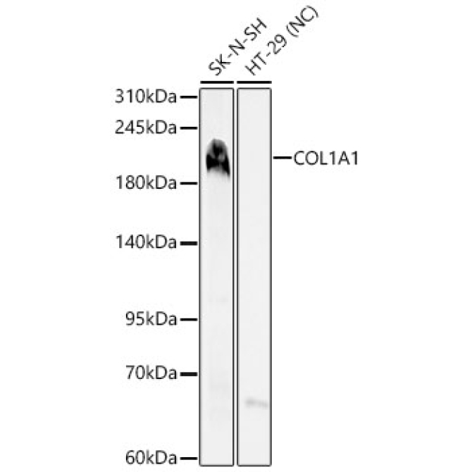 COL1A1 Rabbit Polyclonal Antibody