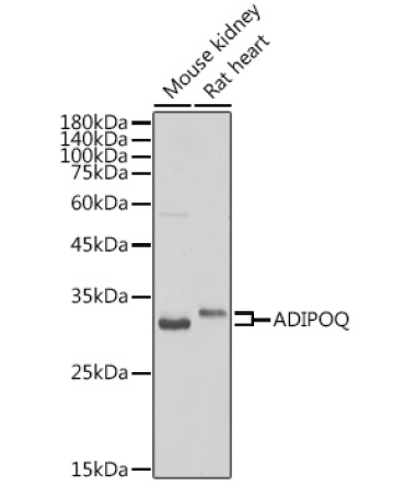 Adiponectin Rabbit Polyclonal Antibody