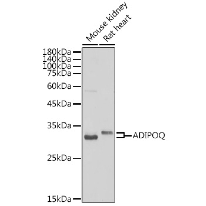 Adiponectin Rabbit Polyclonal Antibody